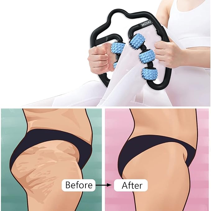 Cellulite Massage Tool Muscle Roller - Deep Fascia Massager & Dimpled Skin Remover for Legs, Thighs & Buttocks - Anti-Cellulite Roller, Smooth Skin, Pain Reliefs(Black Blue - 6 Wheel)
