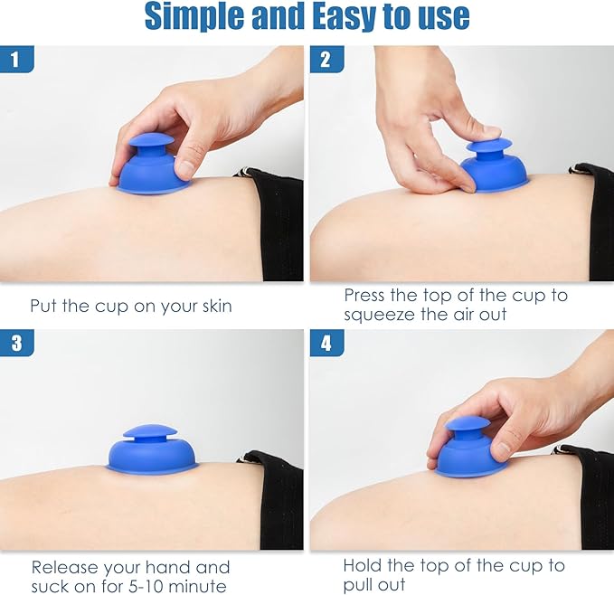 Silicone Cupping Therapy Sets-10pcs Professional Vacuum Cupping for Myofascial Massage/Joint Pain/Anti Cellulite/Deep Muscle Relief & More(10pcs,Blue)